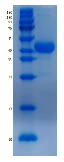 RPA008, Creatine Kinase, muscle (CKM)